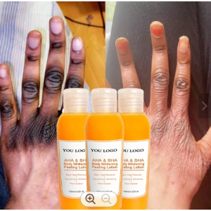 Gel réparateur des taches sur la peau